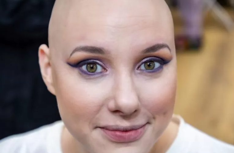 Essex woman with alopecia appears at London Fashion Week